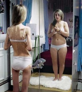 Bulimia en Adolescentes